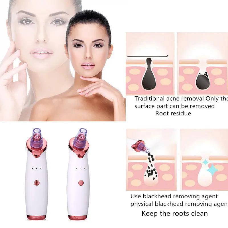 Blackhead Remover Instrument Black Dot Remover Acne Vacuum Suction Face Clean Black Head Pore Cleaning Beauty Skin Care Tool Versatileandeasy