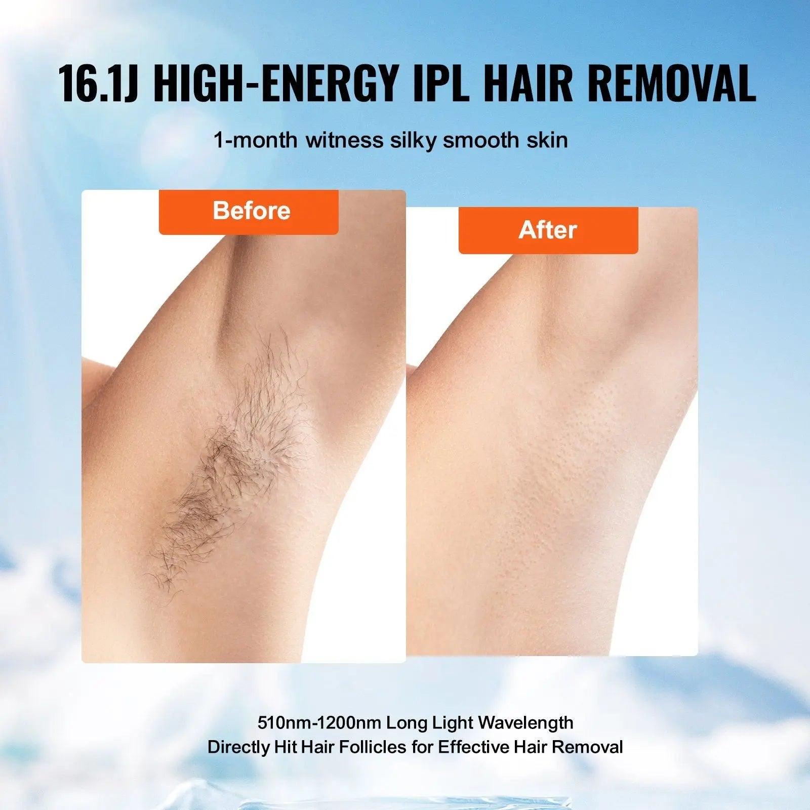 VEVOR IPL Hair Removal, Permanent Hair Removal with Ice Cooling System for Women Men, Auto/Manual Modes & 5 Levels, Painless At-Home Hair Removal Device for Legs, Arms, Armpits, Bikini Line Doba